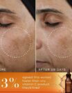 Before and after images showing skin improvement after 28 days using a serum.