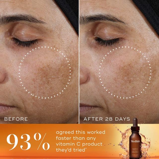 Before and after images showing skin improvement after 28 days using a serum.