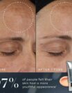 Before and after images showing reduced wrinkles using skin cream.