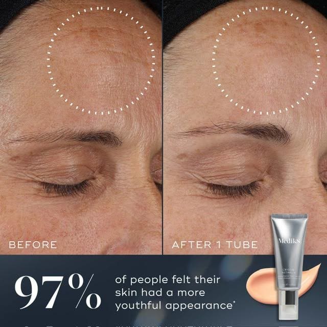 Before and after images showing reduced wrinkles using skin cream.