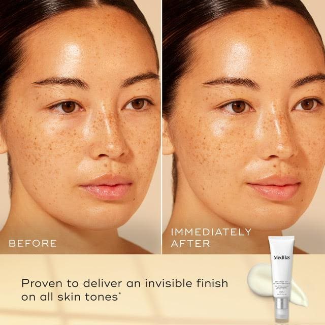 Before and after images showing skin improvement with a skin serum.