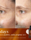 Before and after skincare results showing brighter, youthful skin in 7 days.