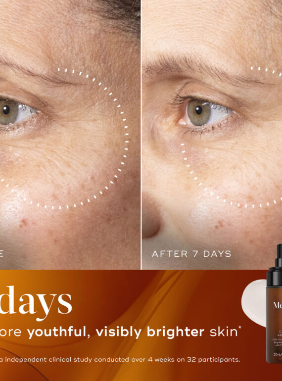Before and after skincare results showing brighter, youthful skin in 7 days.