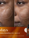 Comparison of facial skin before and after 7 days of product use.