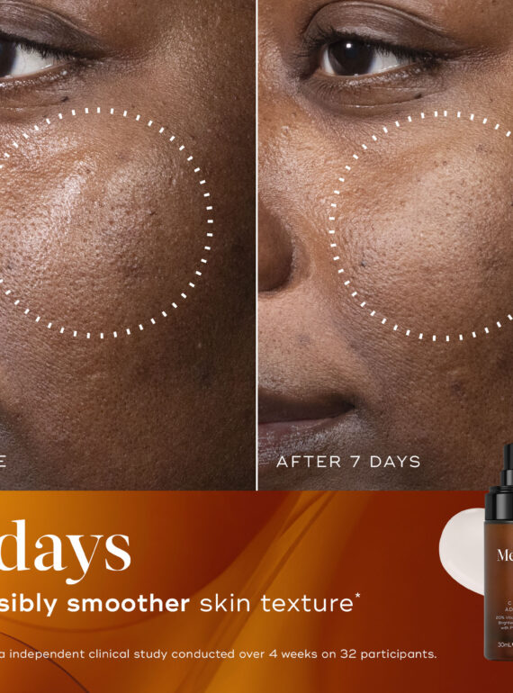 Comparison of facial skin before and after 7 days of product use.